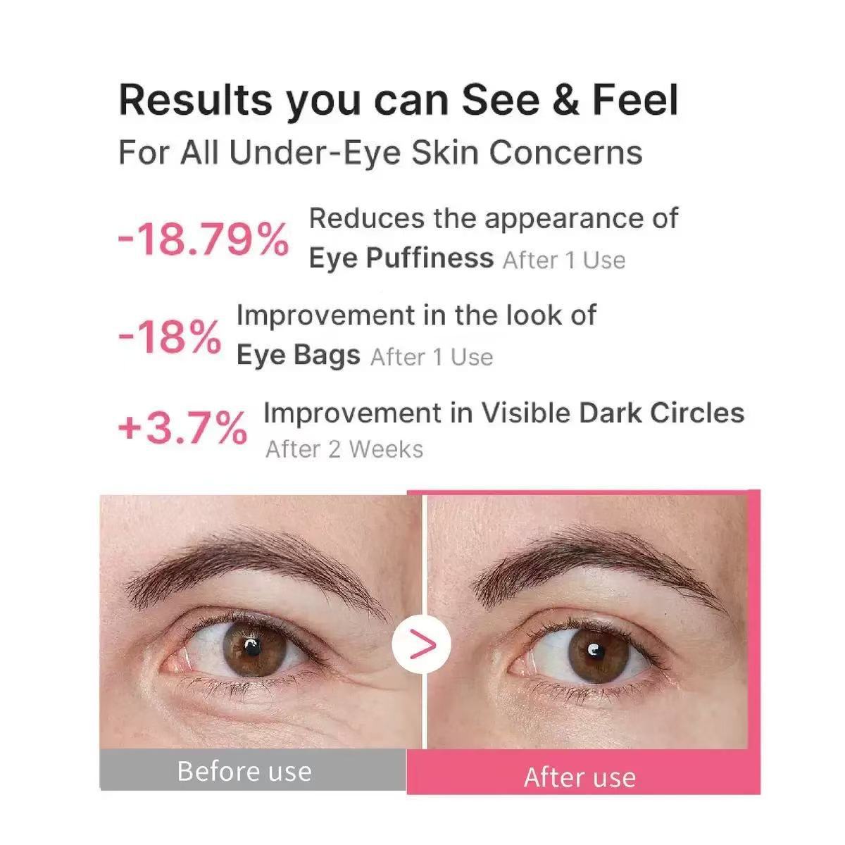 PDRN pink collagen eye patches for dark circle removal, hydration, and lifting